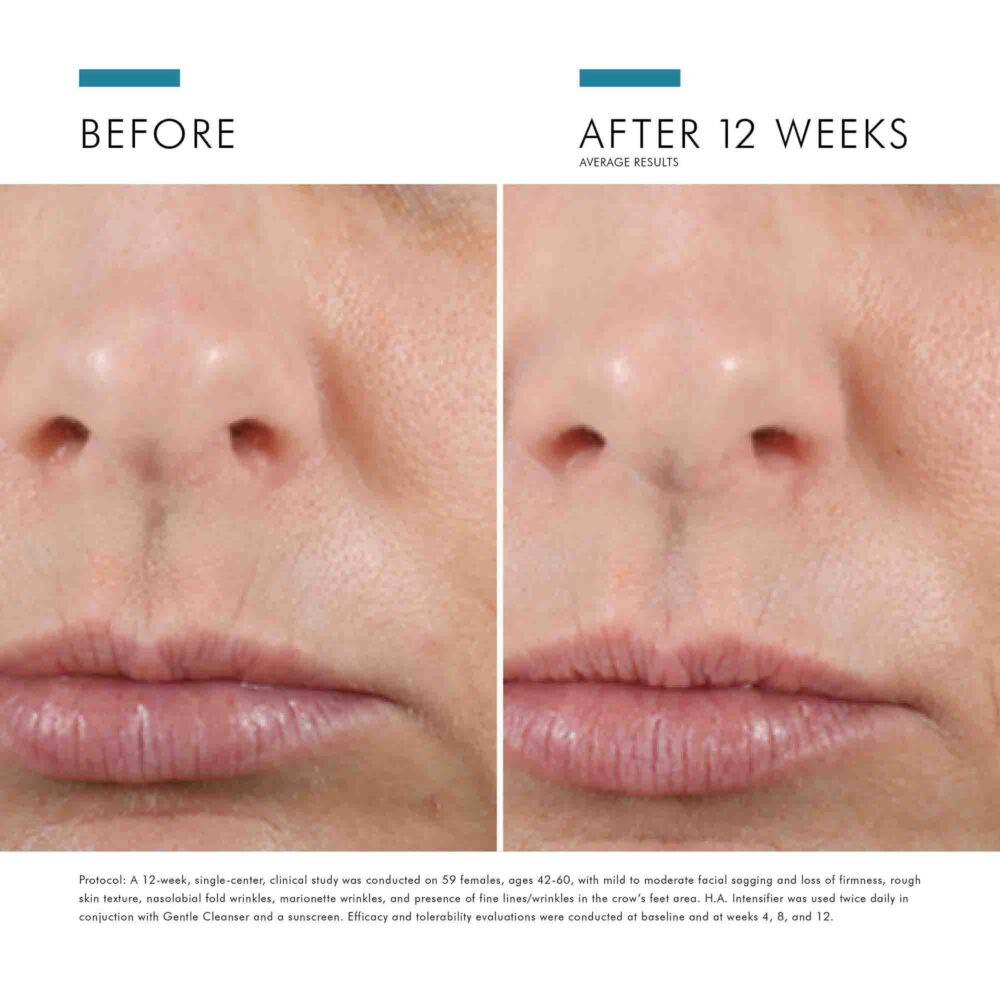 HYALURONIC ACID INTENSIFIER (H.A.)
