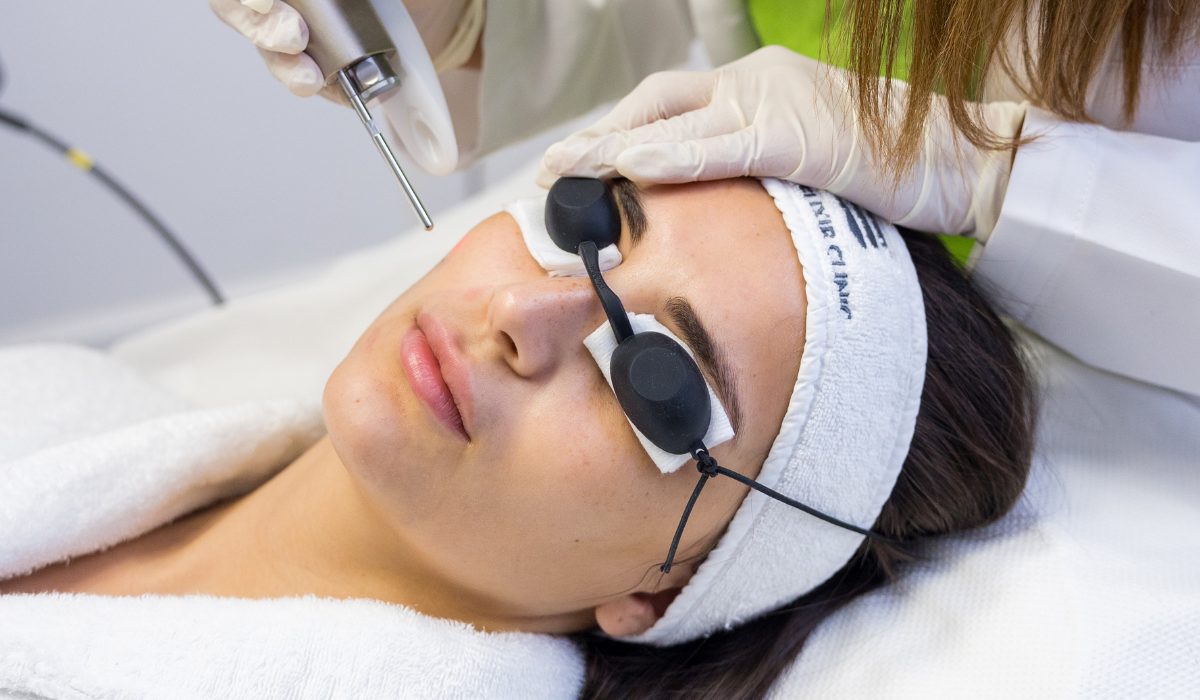 Fotona treatment at The Elixir Clinic