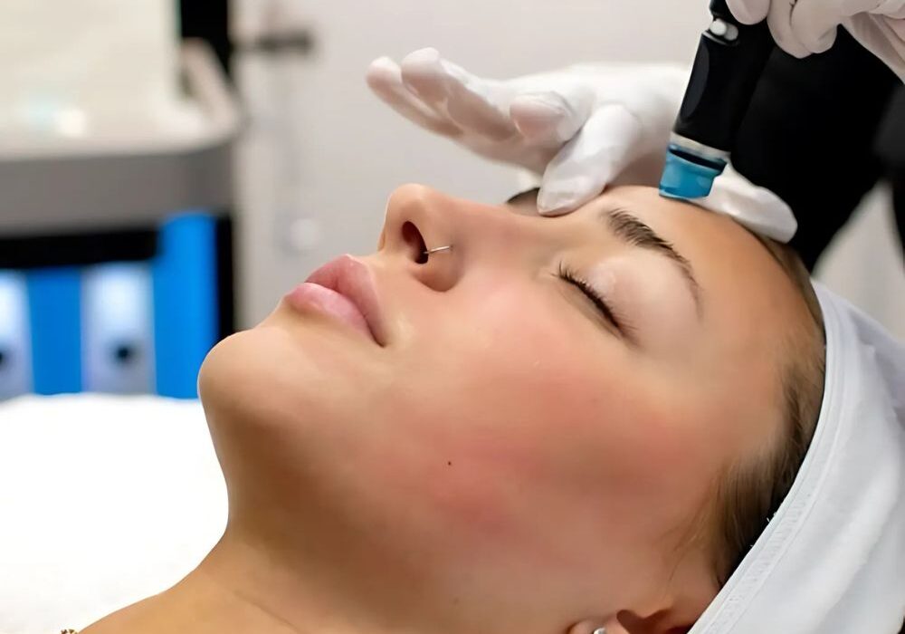 hydrafacial treatment